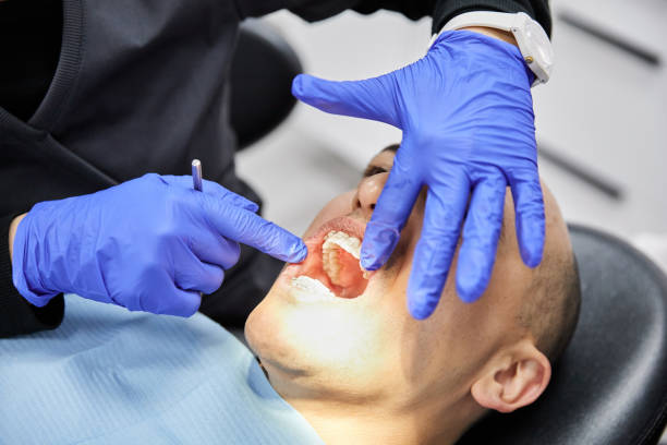 Best Emergency Dentist for Lost Fillings or Crowns in Centralia, MO